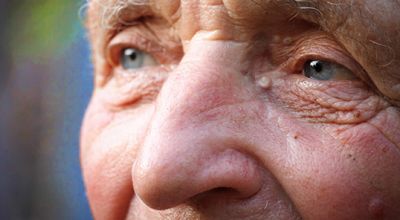 Demenz als Herausforderung in der Pflege